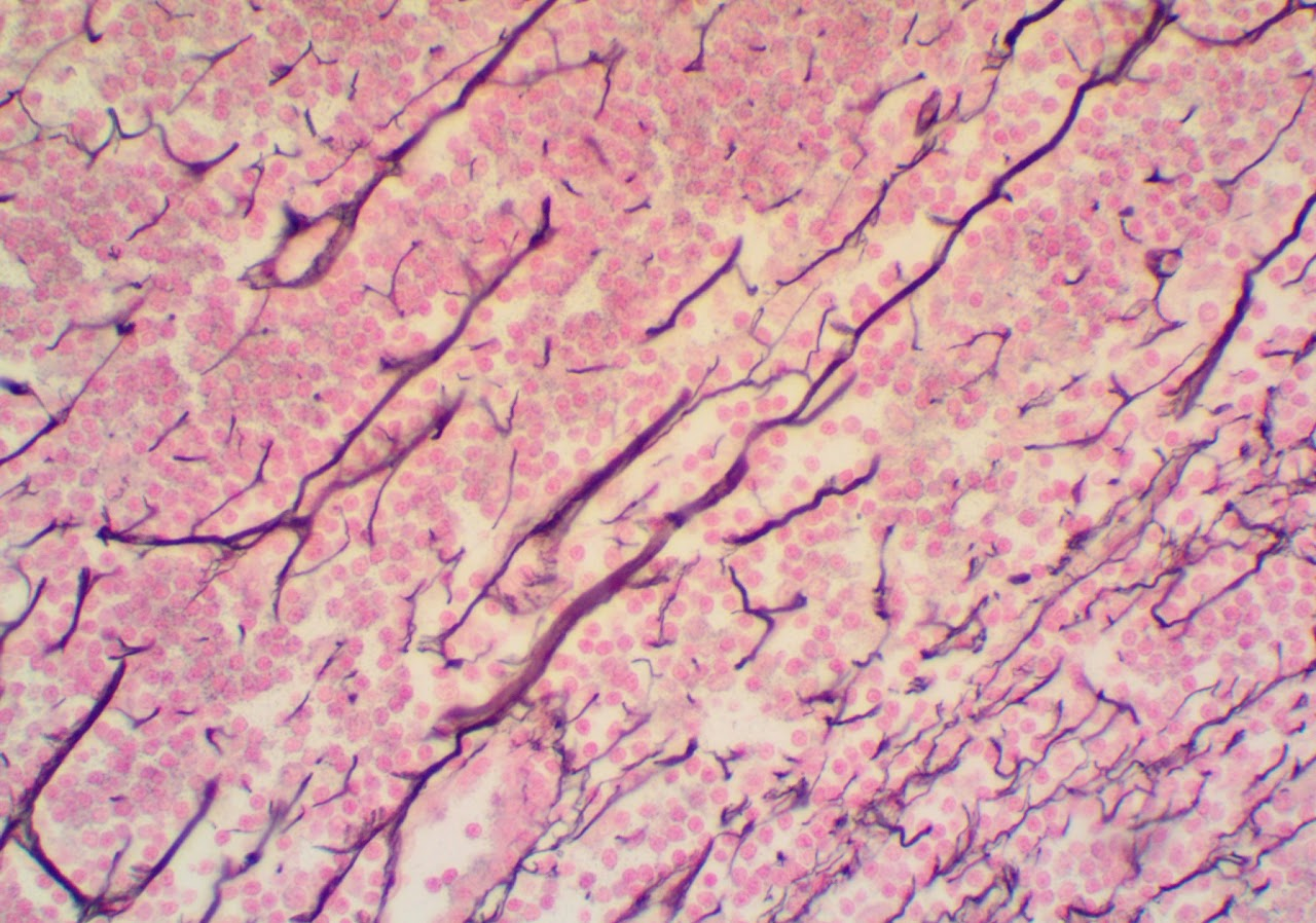 <p><span>Found in lymphatic tissue, such as the spleen</span></p>