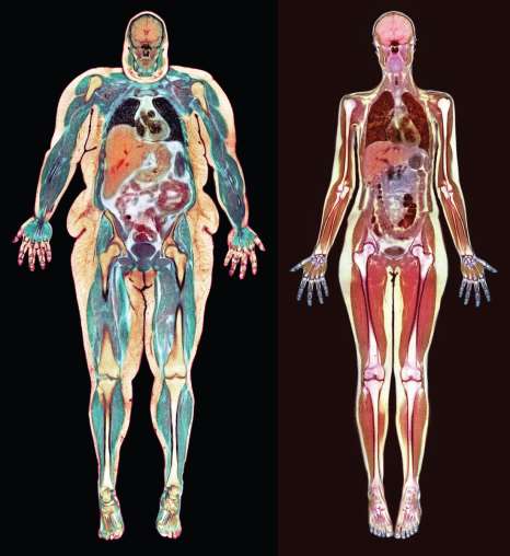 <p>Obesity</p>
