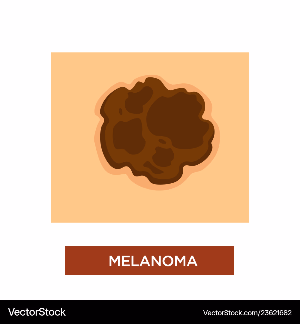 <p><strong>Please explain whether you believe this to be cancerous or not and the type of cancer if it likely is if it is cancerous.&nbsp;</strong></p>