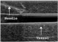 <p>What axis is this?</p>