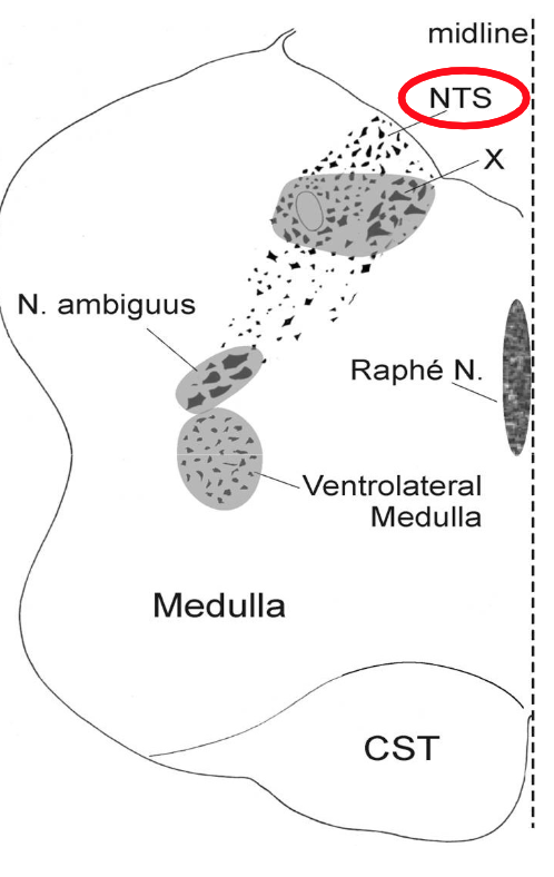 <p>Where is the baroreflex located?</p>