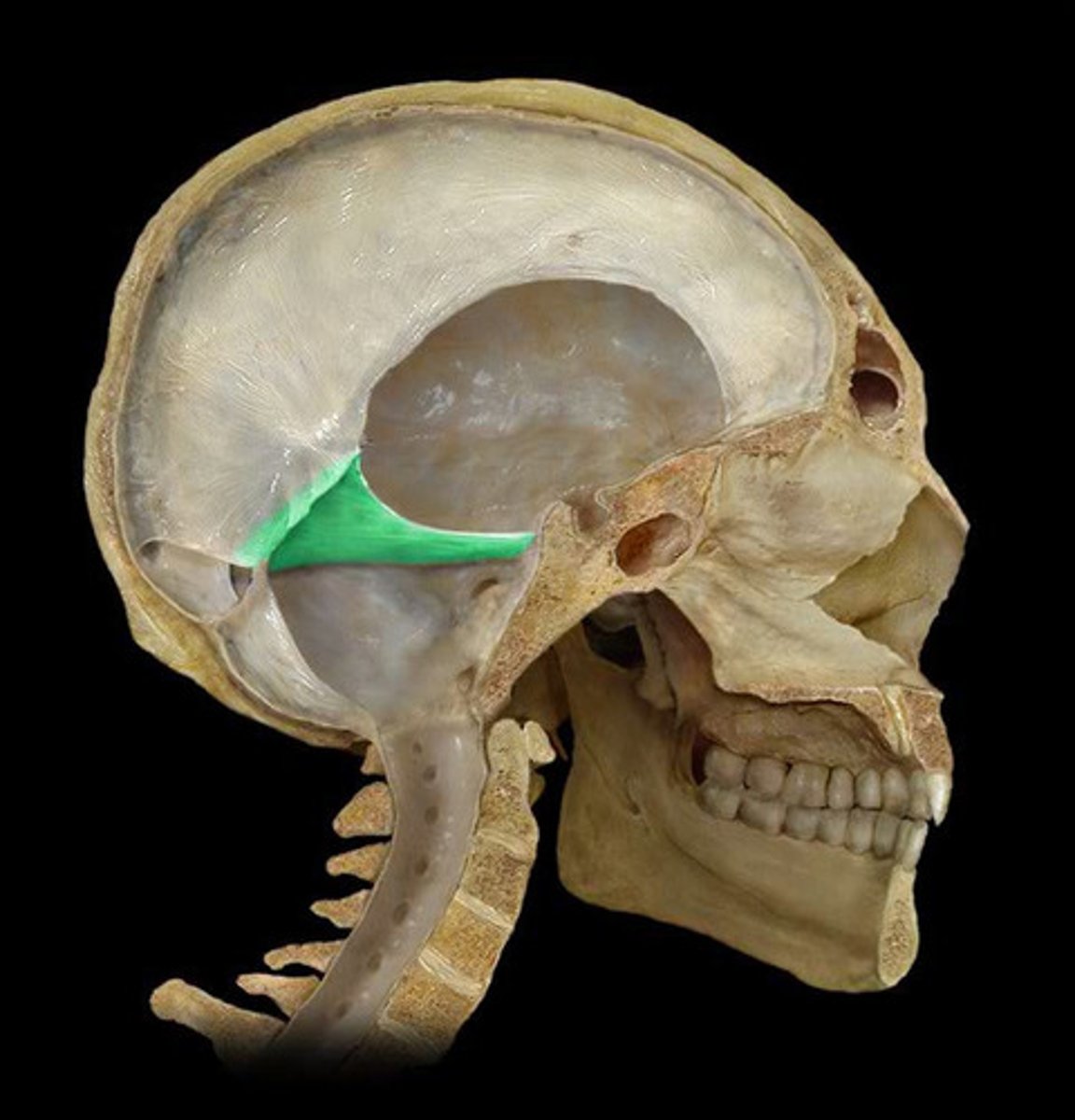 <p>separates cerebral cortex (supratentorial) from cerebellum (infratentorial)</p>