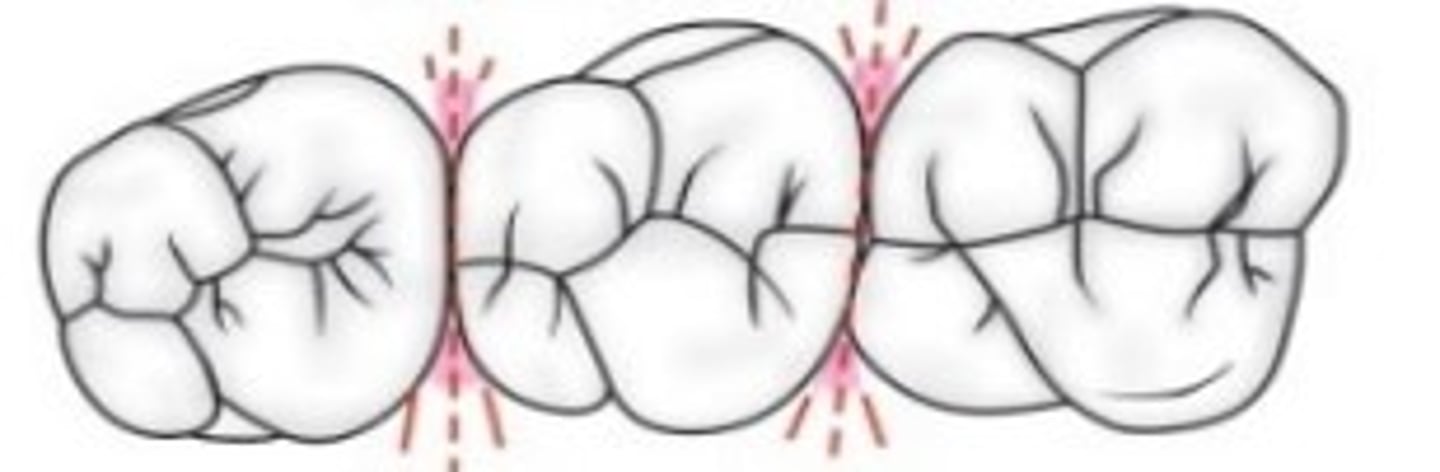 <p>The spaces formed around the point of contact between proximal surfaces of adjacent teeth are called _________.</p>