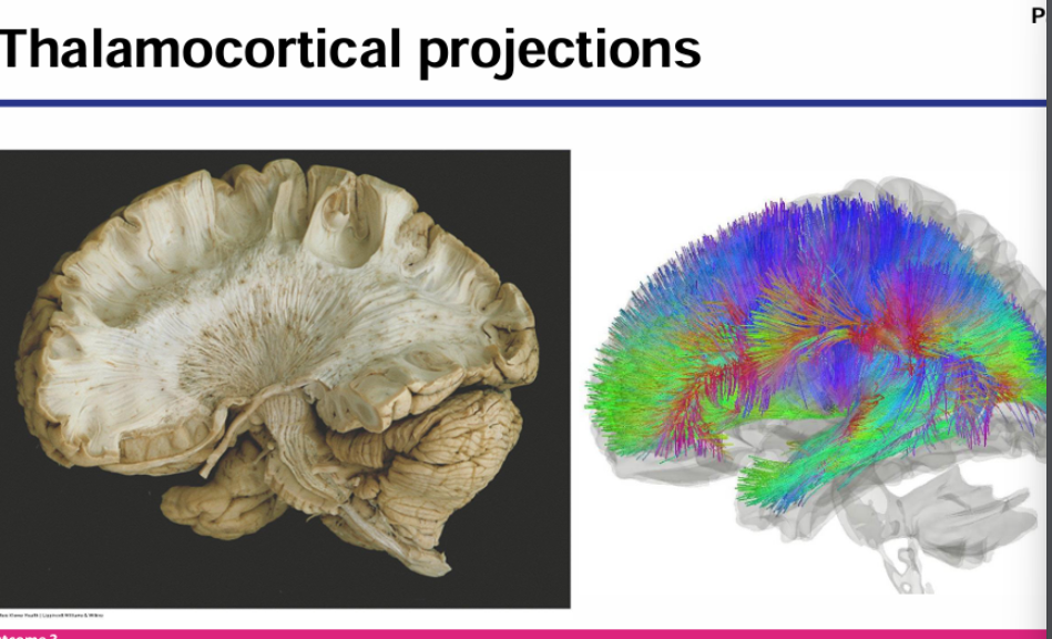 <p>Thalamocortical projections are the primary drivers of cortical activity in sensory areas</p>