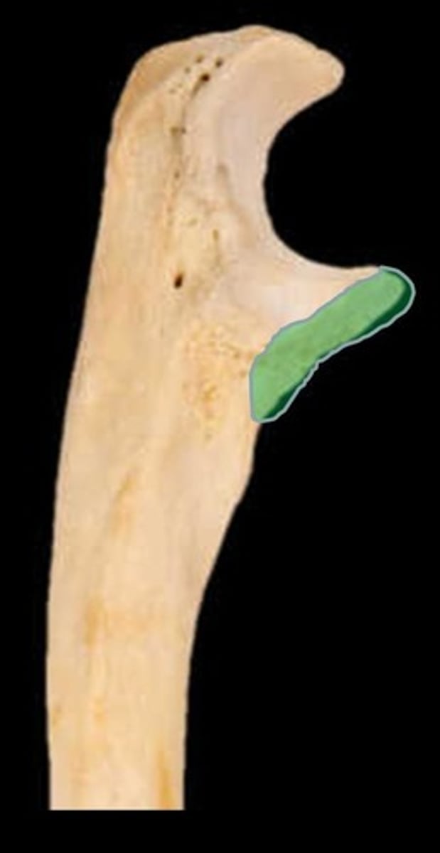 <p>ID structure in blue</p>