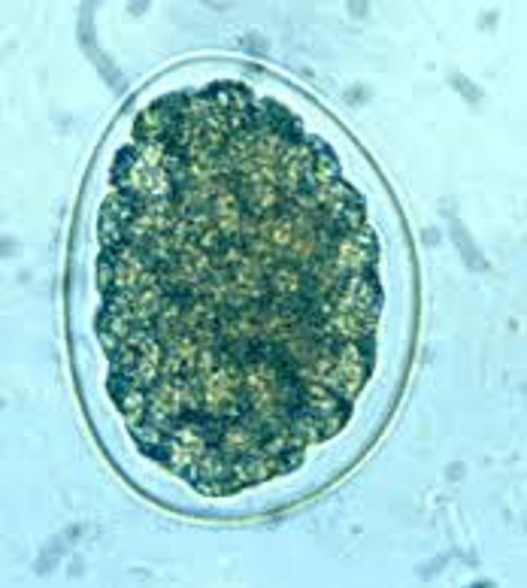 <p>female reproductive cell - lots of cytoplasm</p>