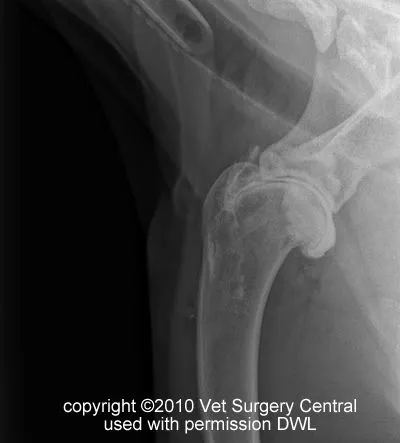 <p>Direct palpation of origin of biceps brachii muscle (BBM). BBM retraction test.</p><p>Radiography (see irregularity of intertubercular groove. Mineralisation of tendon), USG, MRI, Arthroscopy.</p>