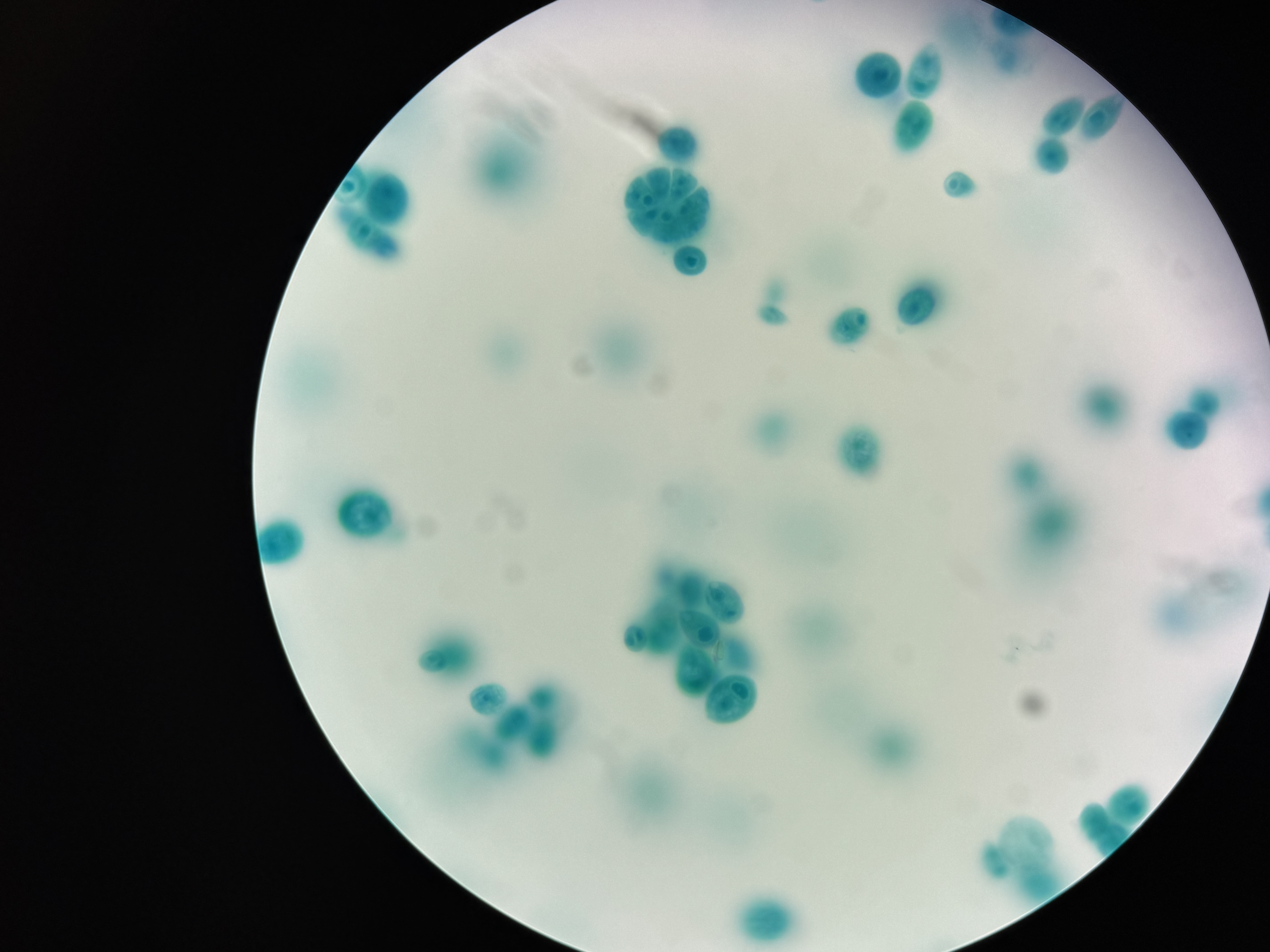 <p>Chlamydomonas</p>