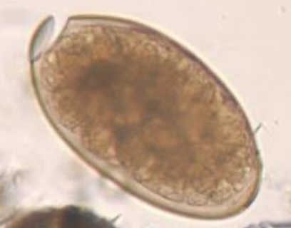 <p>140-75 um</p><p>operculum</p>