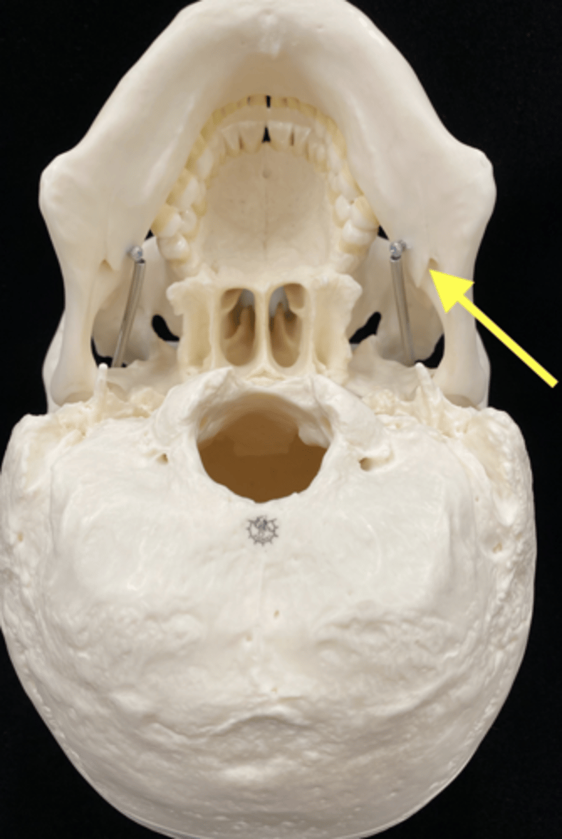 <p>name the bone and bone featur</p>