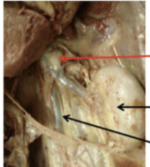 <p><strong>whats this? red line</strong></p>