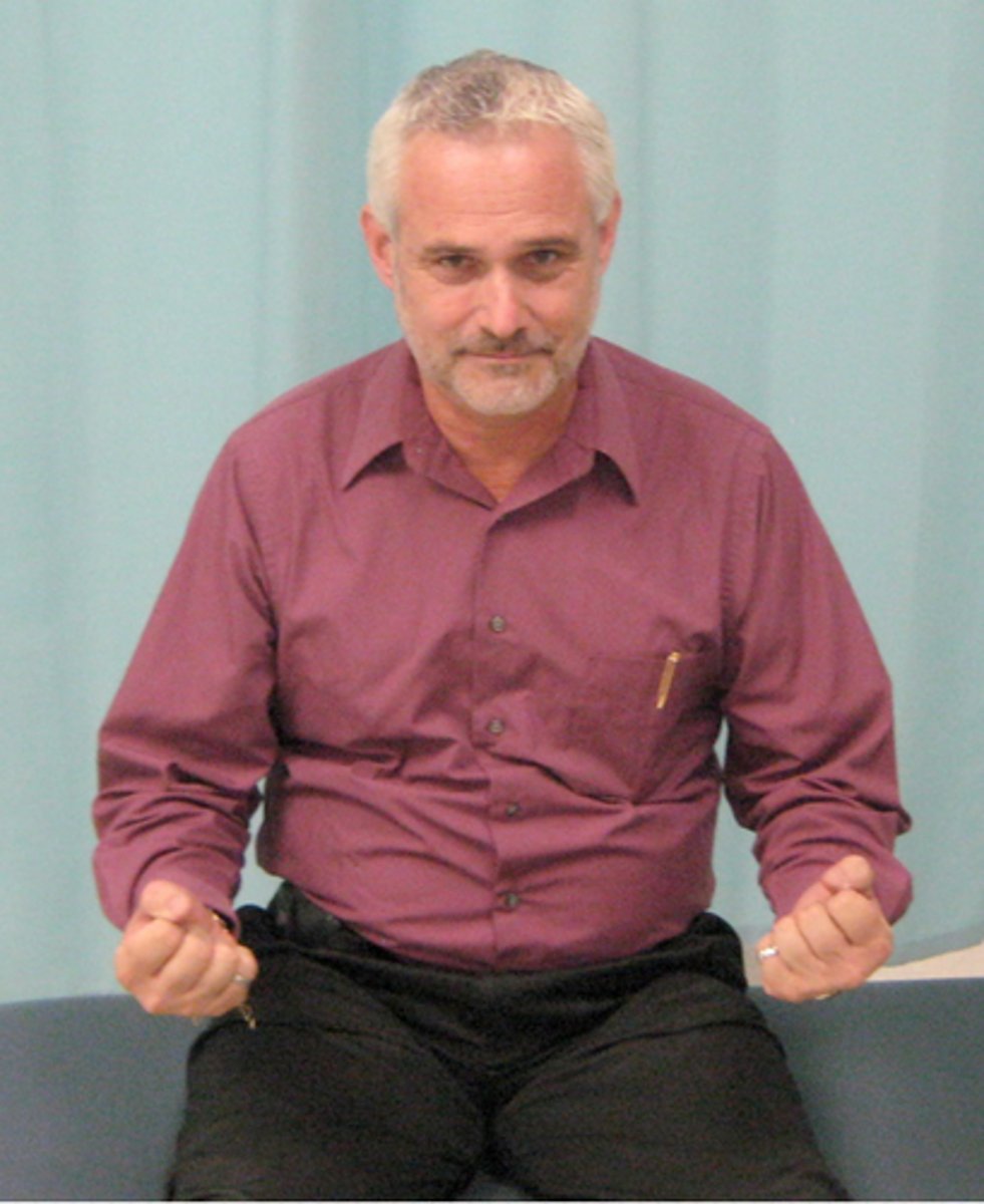 <p>-Essentially flaccid and no reflex action of detrusor muscle</p><p>-Involving T12/L1 and below</p><p>-Bladder empties with increased intra-abdominal pressure</p><p>(can use Valsalva or Crede's maneuver) to empty</p><p>-Have high residual urine volume (can't get it all out)</p><p>Tx: Still will intermittent cath to keep volumes below 500-600 mL</p>