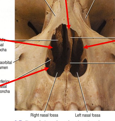 <p>What is the bottom left arrow?</p>
