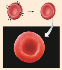 <p>Les cellules gardent leur taille et leur forme normales dans une solution isotonique (même concentration de soluté non diffusible qu’à l’intérieur des cellules ; L’eau entre dans les cellules et en sort).</p>