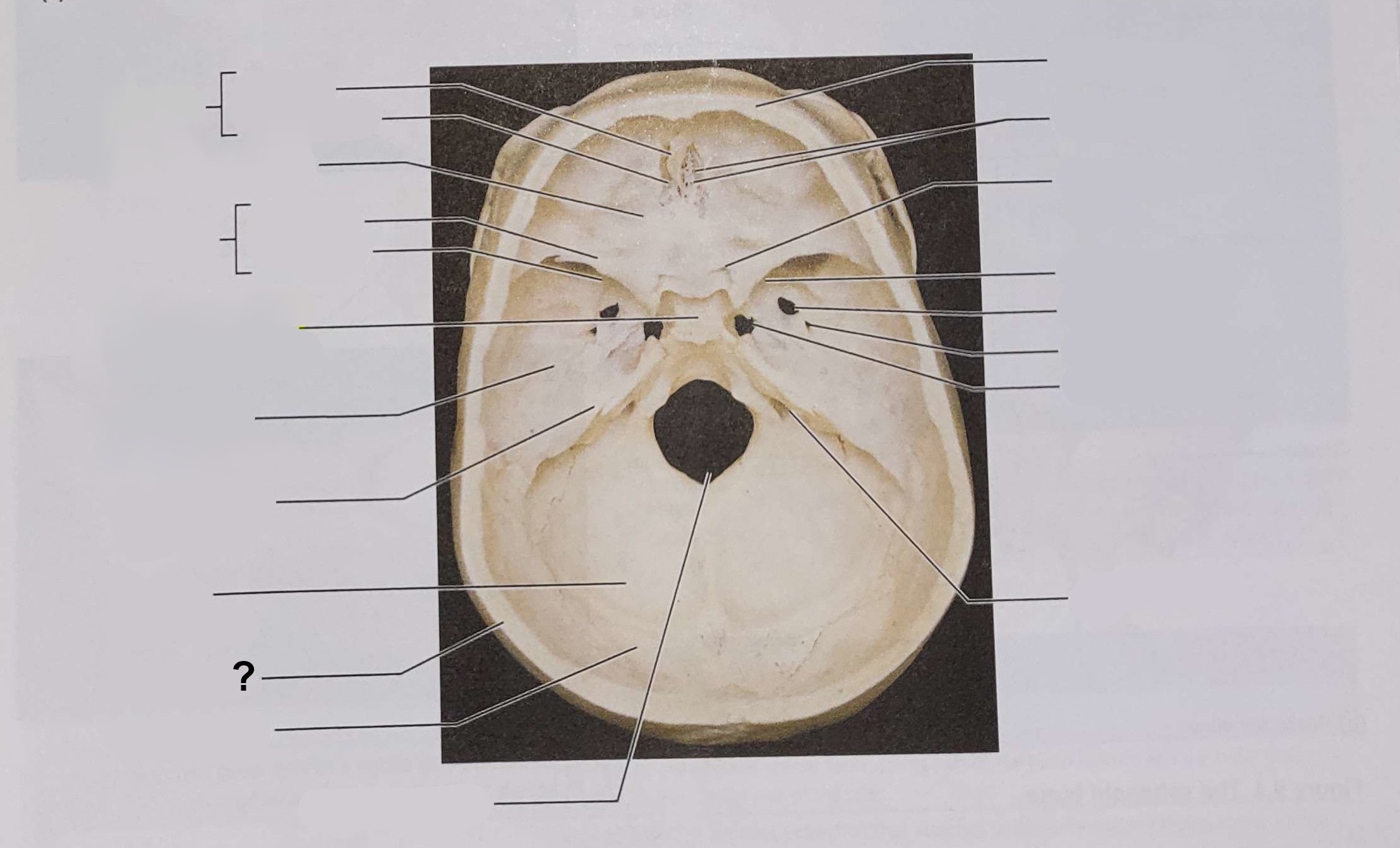 <p>Name the indicated structure</p>