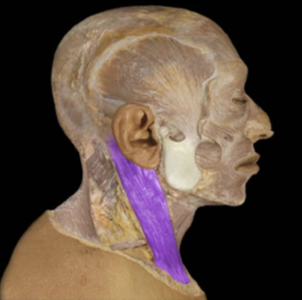 <p>Origin of Sternocleidomastoid</p>