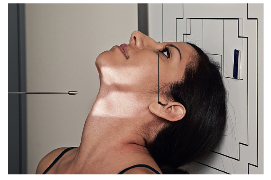 <p>Special: What <u>lines</u> are used for <strong>SMV </strong>for <strong>sinuses?</strong></p>