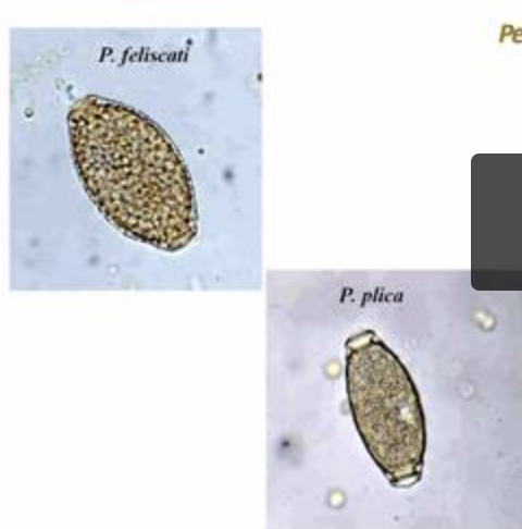 <p>ID the parasite egg</p>