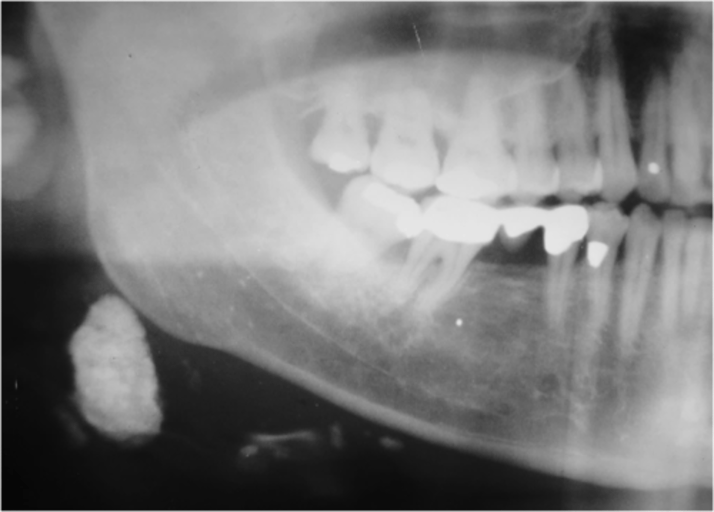 <p>ID the pathology:</p>