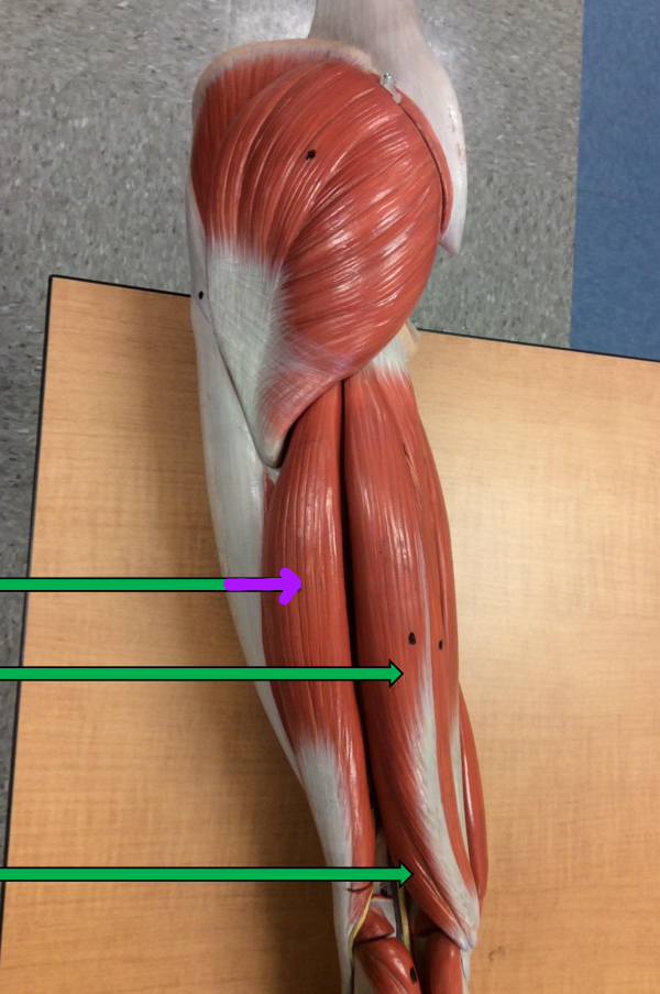 <p>Identify this muscle?</p>