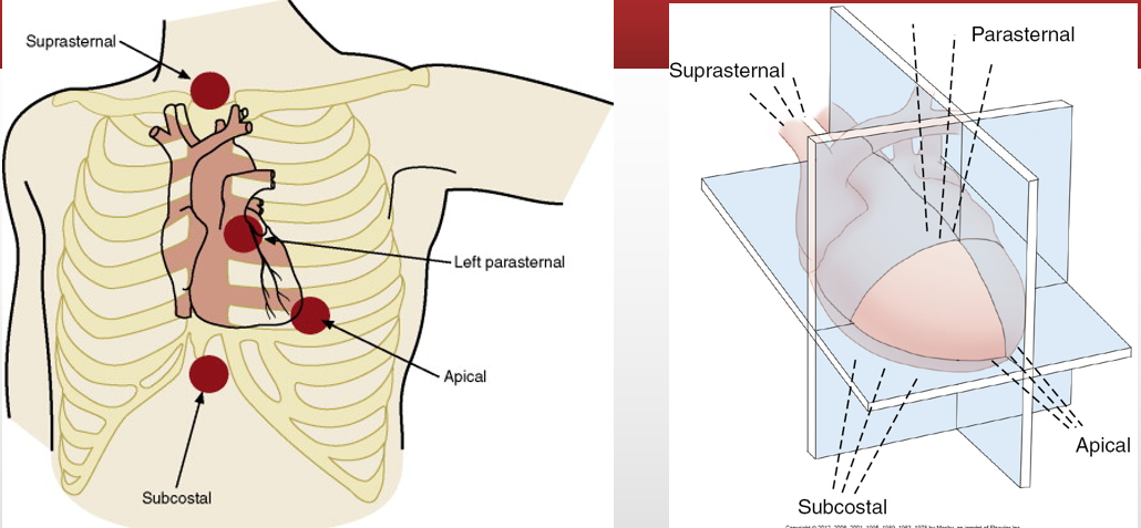 <p>Chap 32&nbsp;</p><p>What is the transducer location when it is placed in the suprasternal notch?</p>