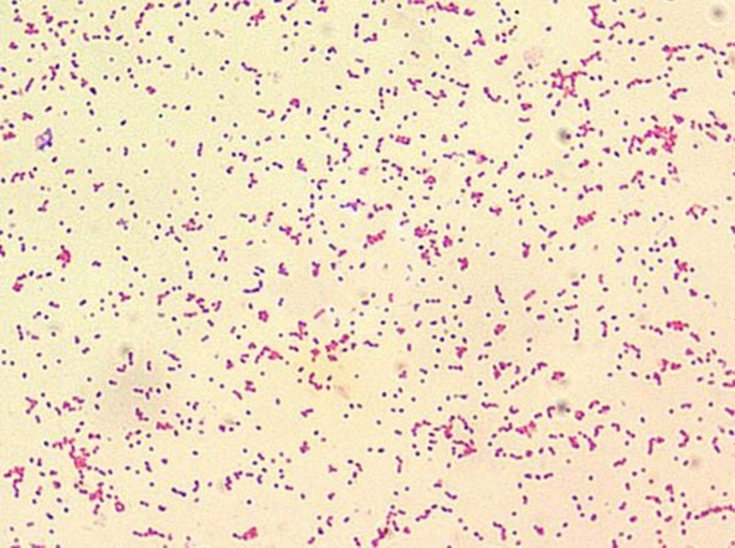 <p>Gram negative coccibacillus intracellular</p><p>Affects the reproductive system</p><p>Causes infertility, abortions, testicular swelling</p><p>Zoonotic</p>