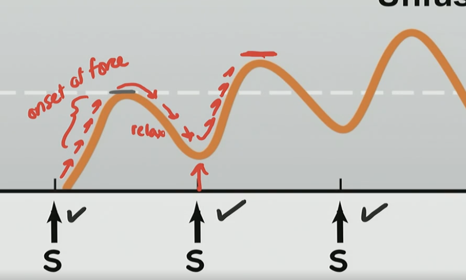 <p>What is this phenomenon?</p>
