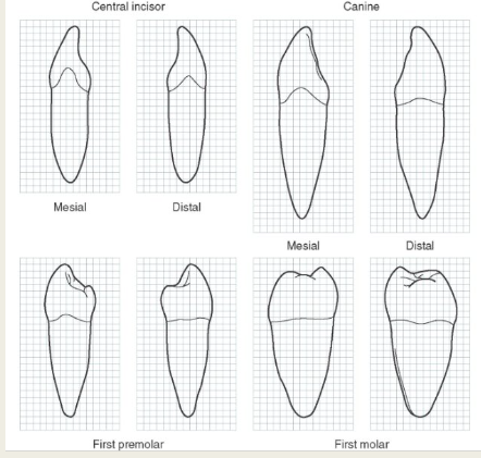 <p>Curvature depends on the height of the contact area above the crown cervix and on the diameter of the crown labiolingually or buccolingually.</p><p>Mesial curvature of a tooth is greater than the distal curvature of the same tooth.</p><p>Mandibular anterior teeth show less curvature than their maxillary counterparts. </p><p>Posterior teeth in both arches show little variation</p><p>Curvature of the CEJ is usually about 1 mm less on the distal surface of the tooth than on the mesial surface. </p>