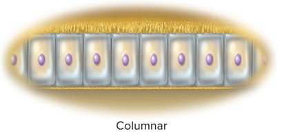 <p>Columnar</p>
