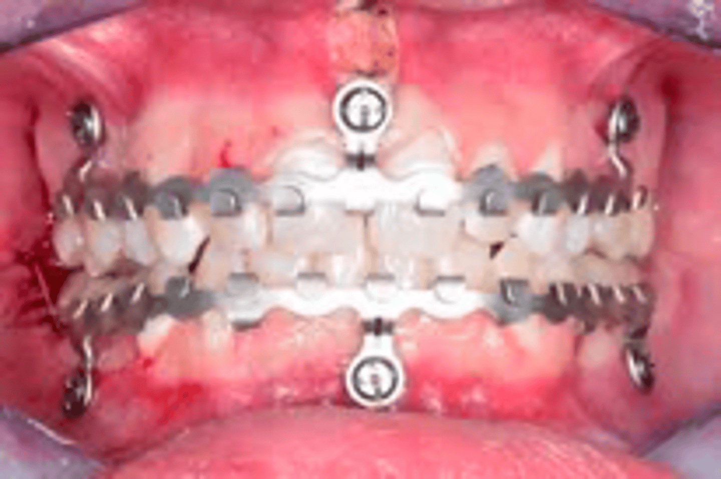 <p>ID the MMF device:</p>