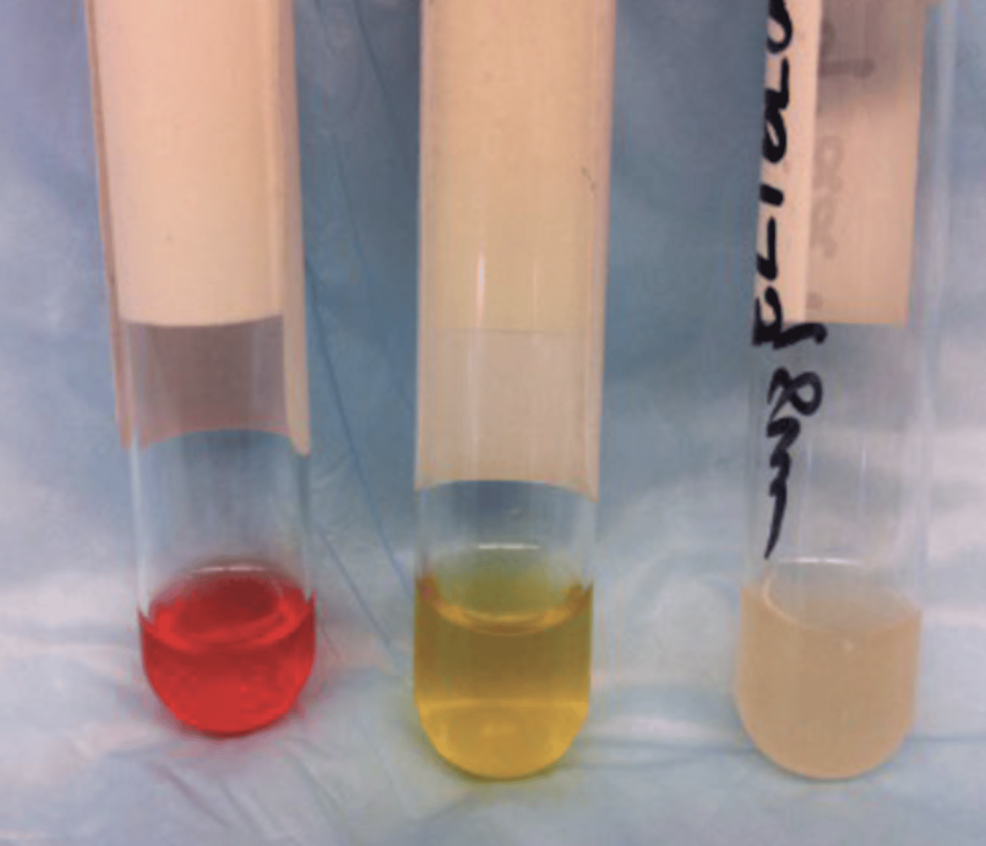 <p>What is the problem in the serum sample on the left?</p>