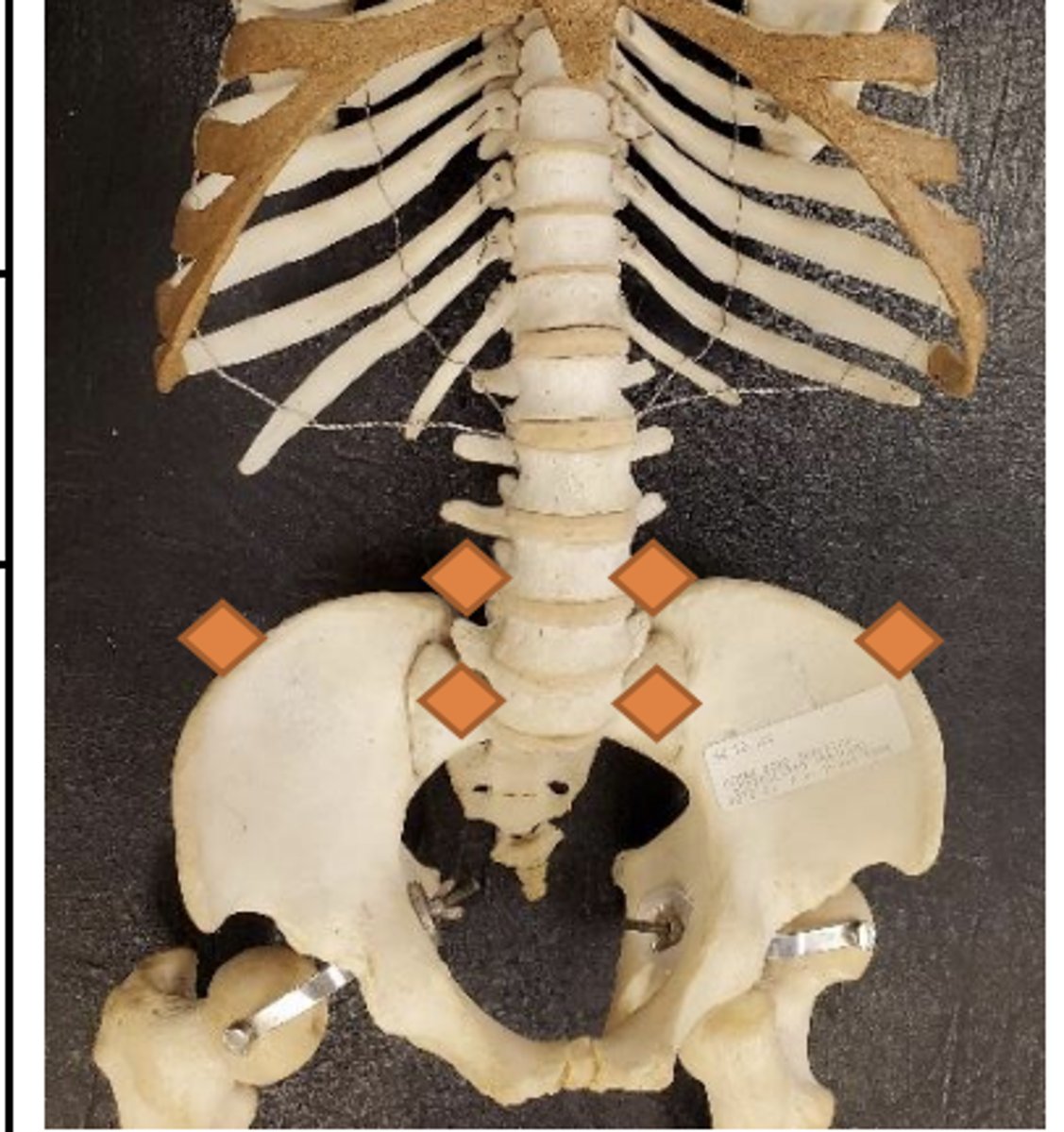 <p>Anterior superior margin of iliac crest at mid-axillary line</p>