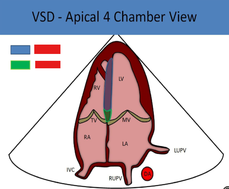 <p>what vsds are pictured</p>