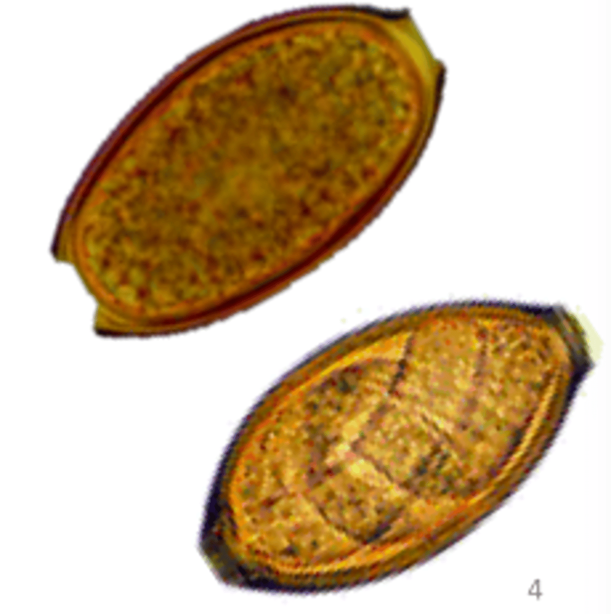 <p>Trichuris vulpis</p>