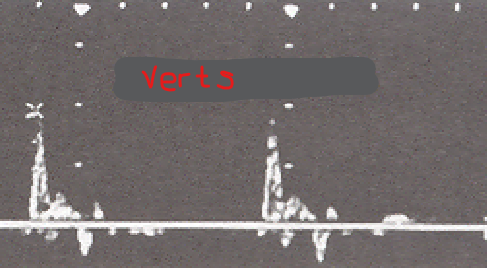 <p>Identify this image. </p>