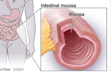 <p>intestinal mucosa <em>(</em><span><em><span>the innermost, highly folded lining of the gut)</span></em></span></p>