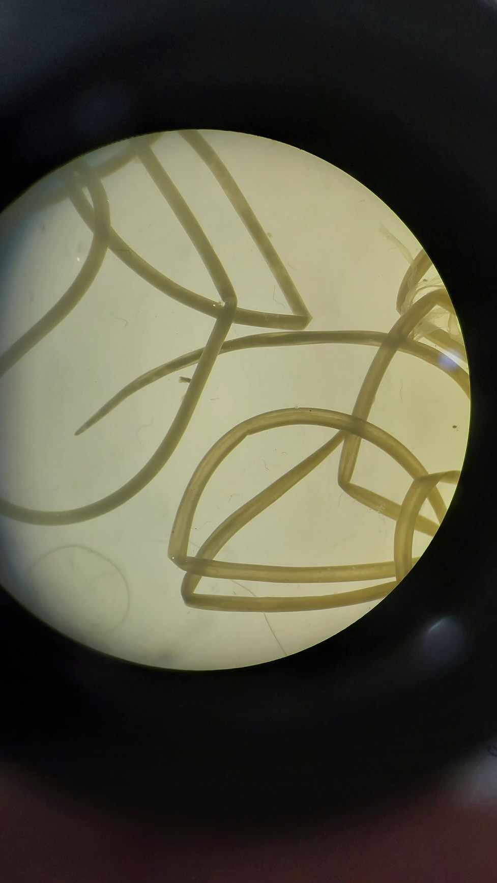<p>Identify. Give the SN and CN of this worm</p>