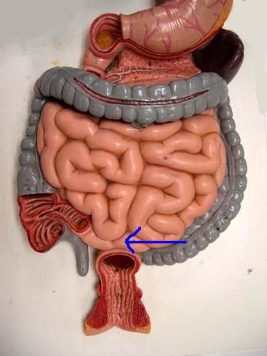 <p>Specific</p>