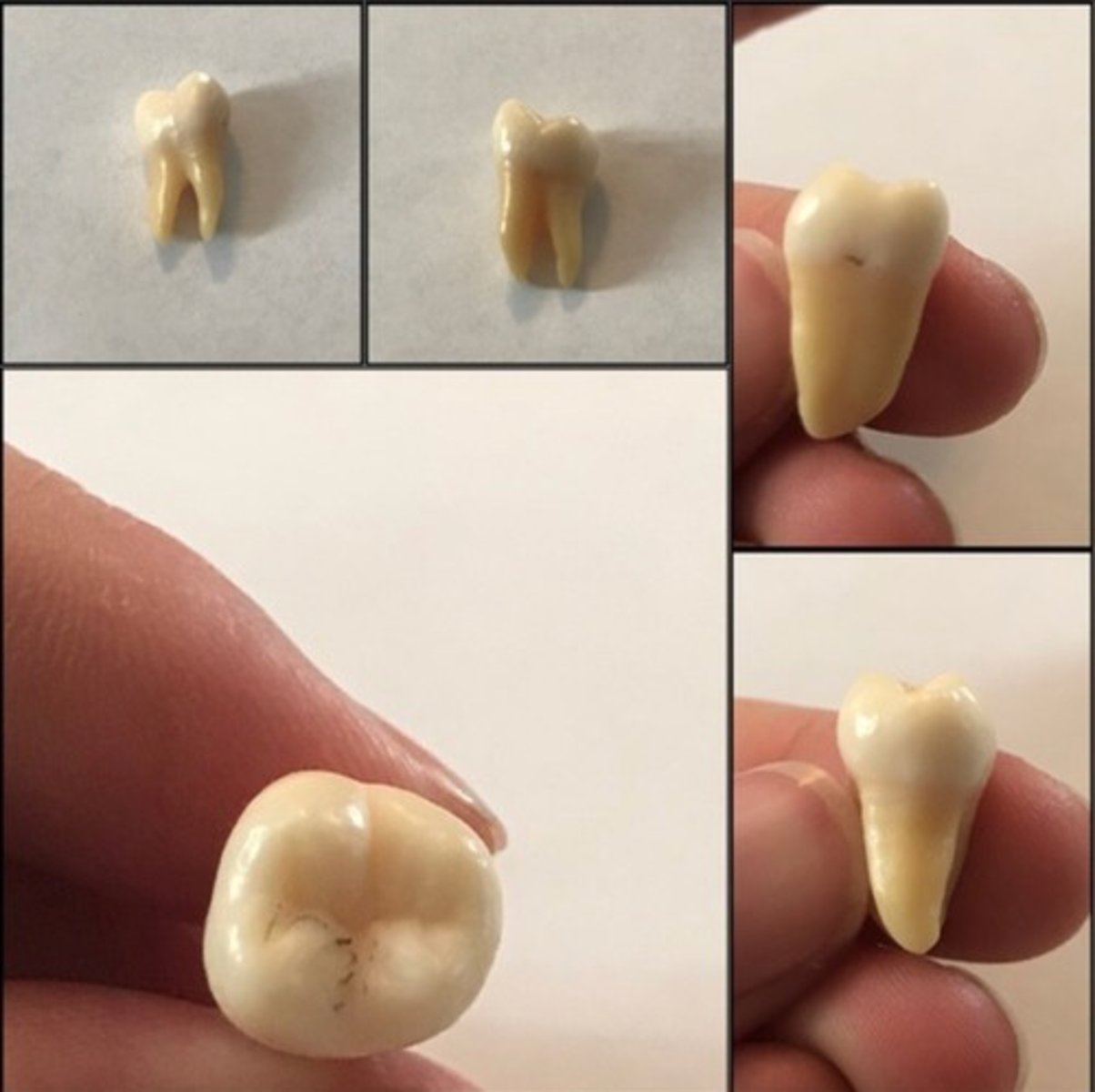 <p>What tooth is this ?</p>