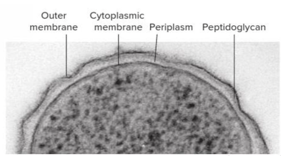 <p><span style="font-family: proxima_novaregular; color: rgb(34, 34, 34)">This figure shows a micrograph of a Gram_____bacterium.</span></p>