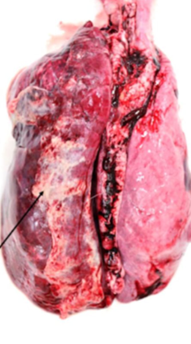 <p>What kind of inflammation is present?</p>