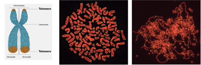 <p><span style="background-color: inherit; line-height: 22px; color: windowtext;"><span>Knockout of key component of shelterin protein complex</span></span><span style="line-height: 22px; color: windowtext;"><span>&nbsp;</span></span></p><ul><li><p class="Paragraph SCXO178230134 BCX0" style="text-align: left;"><span style="background-color: inherit; line-height: 22px; color: windowtext;"><span>Dysfunction where chromosomes no longer stable, start to fuse together&nbsp;</span></span><span style="line-height: 22px; color: windowtext;"><span>&nbsp;</span></span></p></li></ul><p></p>