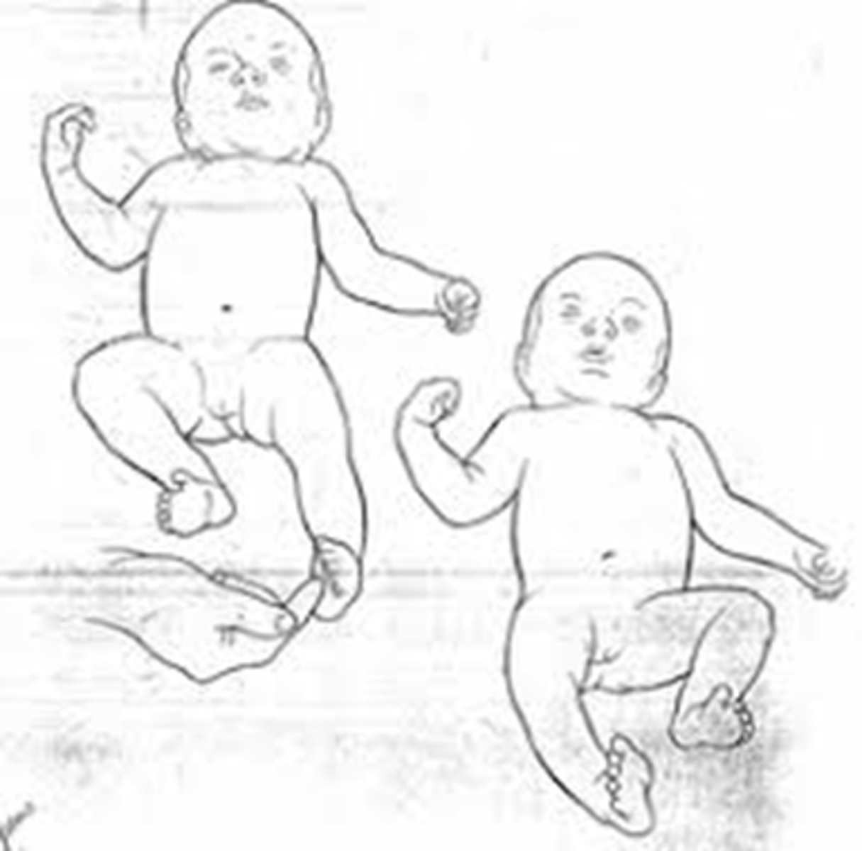 <p>noxious stim to foot causes flexion of knee to withdraw from stimulus</p>