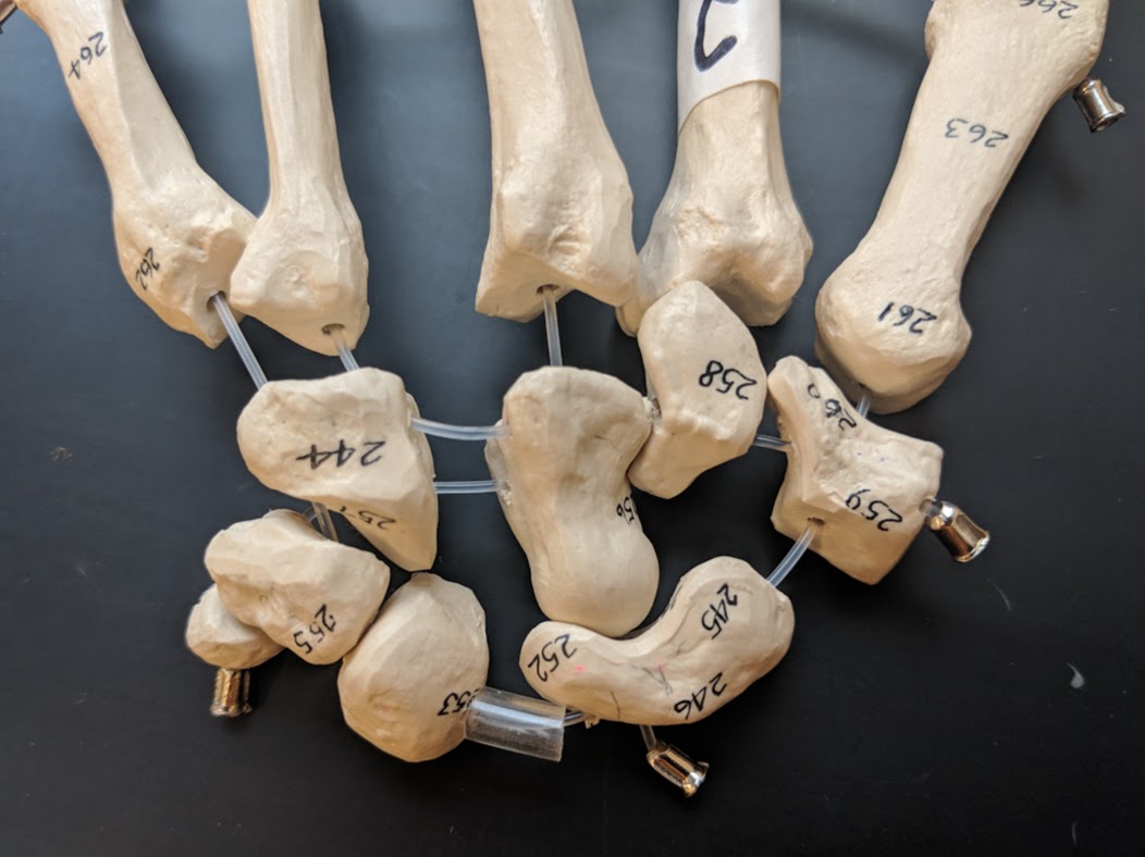 <p>Name these bones</p>