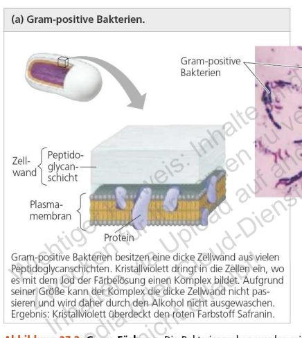 <p>Gram-positive Bakterien haben</p>