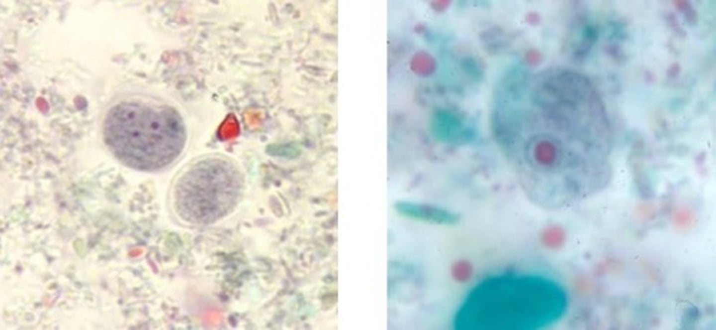 <p>• Cyst (left)</p><p>o No peripheral chromatin</p><p>o 4 nuclei with karyosomes</p><p>• Trophozoite (right)</p><p>o 6-10 microns</p><p>o Hard to distinguish from</p><p>Iodamoeba buetschlii</p>