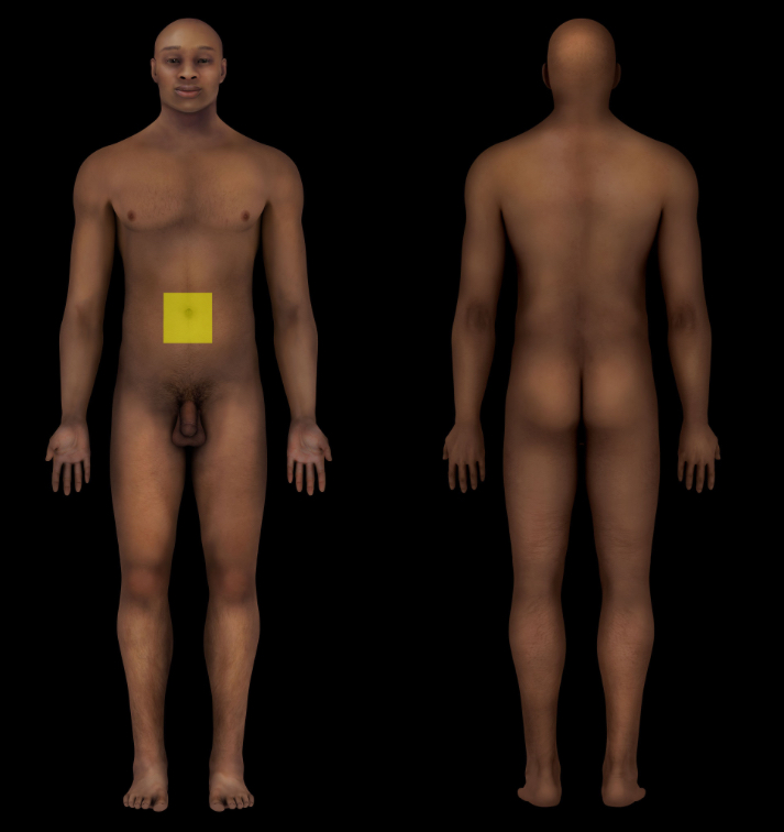term image