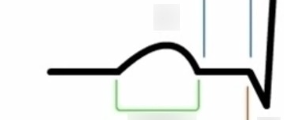 <p>related to the rate of cardiac impulse transmitted from the AV node&nbsp;</p>