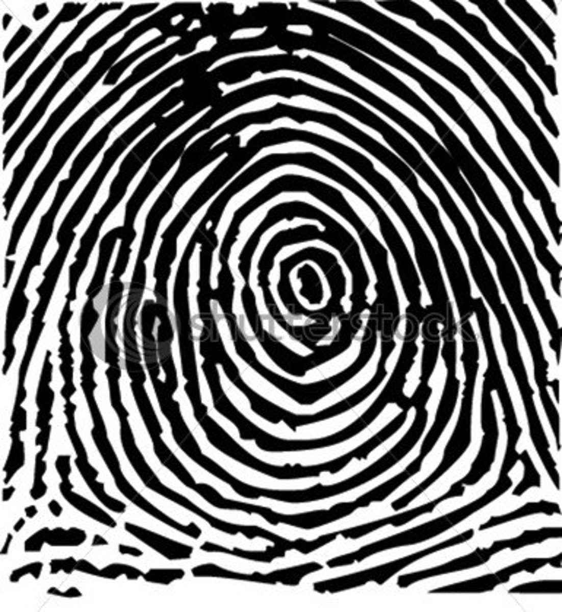<p>-circular pattern radiating around center of finger</p><p>-2 or more deltas</p>