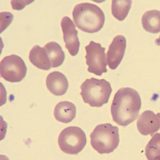 <p>What do these erythrocytes show?</p>